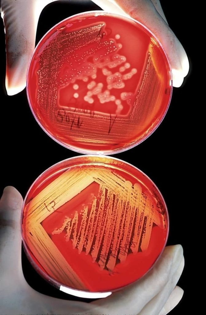 Bacterias mas resistentes