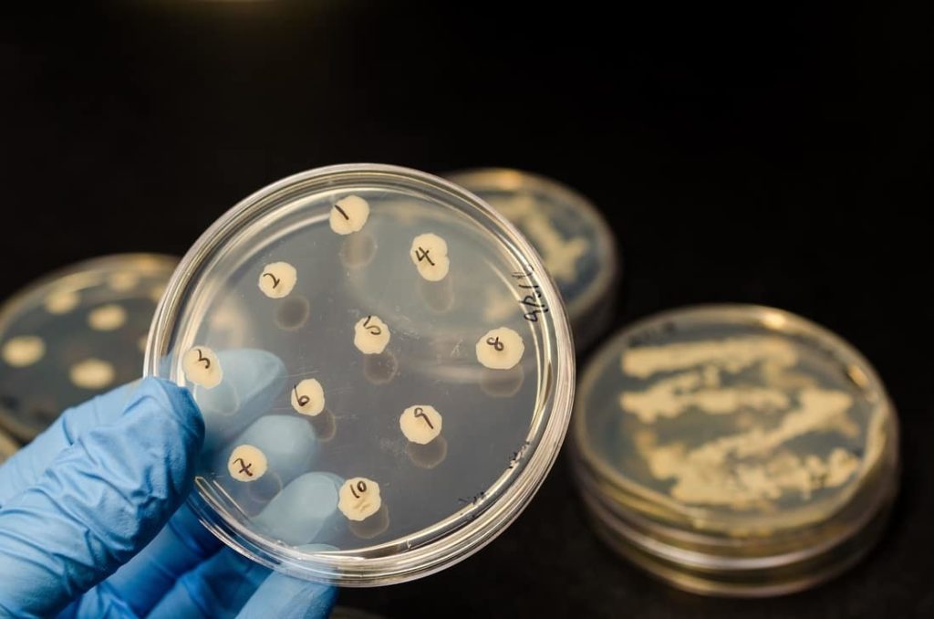 Inventos descubiertos por accidente 1 los inventos descubiertos por accidente antibioticos