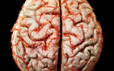 Enfermedad de Huntington: Una extraña patología que afecta el cerebro