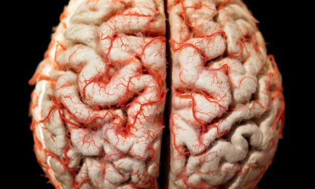 Enfermedad de Huntington: Una extraña patología que afecta el cerebro
