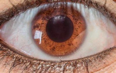 Conoce las enfermedades de los ojos más usuales y peligrosas